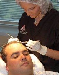 hårtransplantation med FUE-metoden FUT-metoden